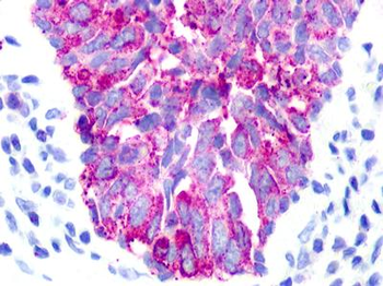 UTS2R/GPR14 Antibody