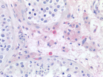 HRH4/Histamine H4 Receptor Antibody