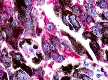 RAIG2/GPRC5B Antibody