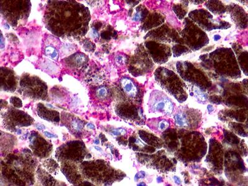 RAIG2/GPRC5B Antibody