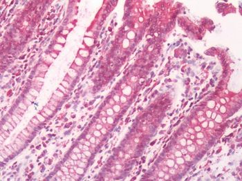 RAIG2/GPRC5B Antibody