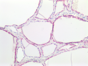 SSTR4 Antibody
