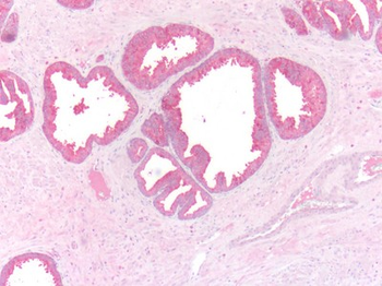 ADRB3 Antibody