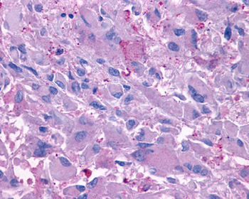 GCGR/Glucagon Receptor Antibody