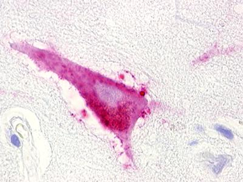 LPAR5/GPR92 Antibody