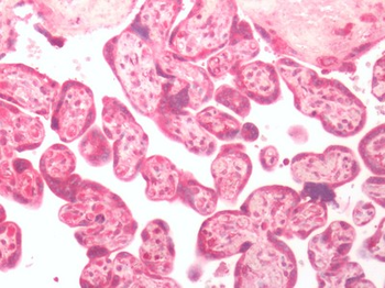 GPER1/GPR30 Antibody