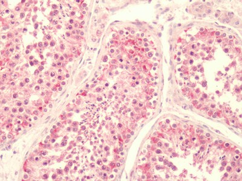 LPAR5/GPR92 Antibody