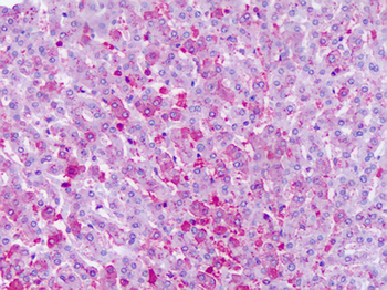 FZD6/Frizzled 6 Antibody