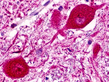 NPFF2/NPFFR2 Antibody