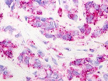 GPR62 Antibody