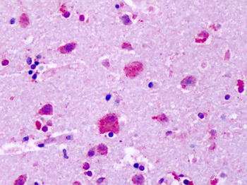 GPR83 Antibody