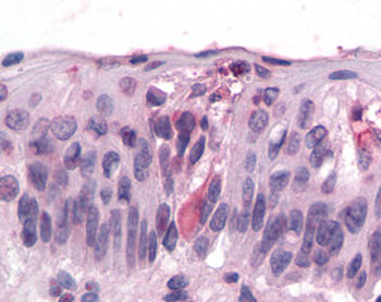 T1R3/TAS1R3 Antibody