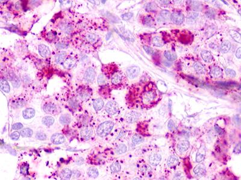 GPR62 Antibody