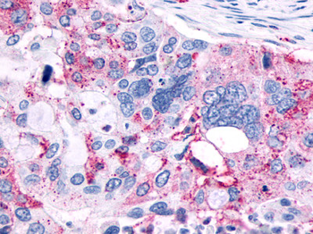MRGPRX3/MRGX3 Antibody