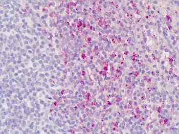 RORC/ROR Gamma Antibody