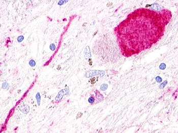 GPR173/SREB3 Antibody