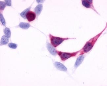 EDNRB/Endothelin B Receptor Antibody