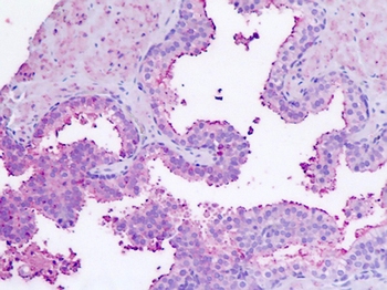 RXFP1/ LGR7 Antibody