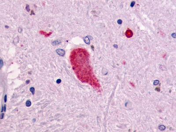 RXFP1/ LGR7 Antibody