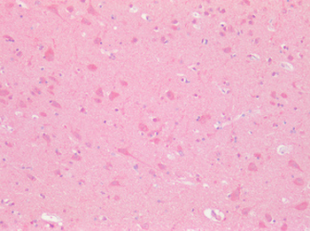 GPRC5D Antibody