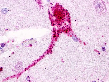 GPRC5D Antibody