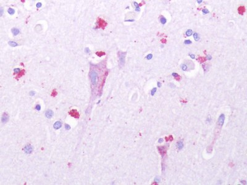 HTR1D/5-HT1D Receptor Antibody