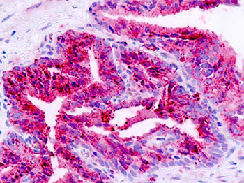 ADGRB1/BAI1 Antibody