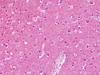 GRM2/MGLUR2 Antibody