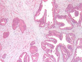 FAP Alpha Antibody