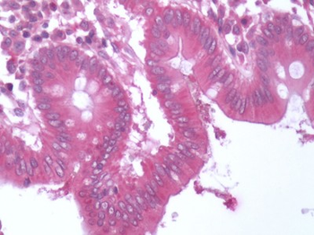BACE1/BACE Antibody