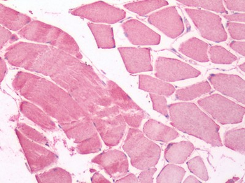 UCHL3 Antibody