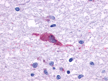 HTR1F/5-HT1F Receptor Antibody
