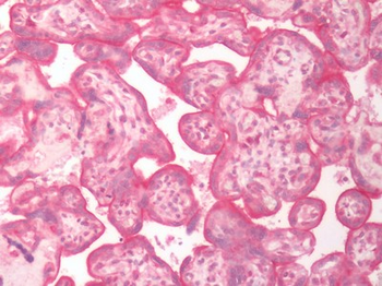 SLC5A6/SMVT Antibody