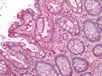 PGES/PTGES Antibody