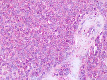 ITGA4/VLA-4/CD49d Antibody