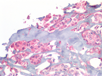 EGFR Antibody