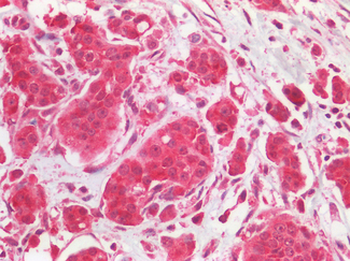 EGFR Antibody