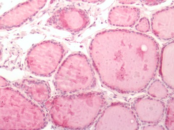 ITGB3/Integrin Beta 3/CD61 Antibody