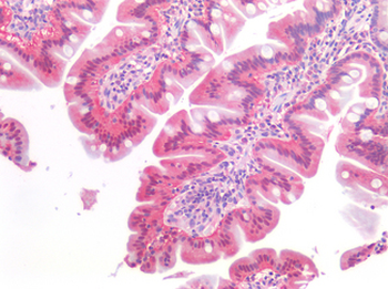 ERBB3/HER3 Antibody