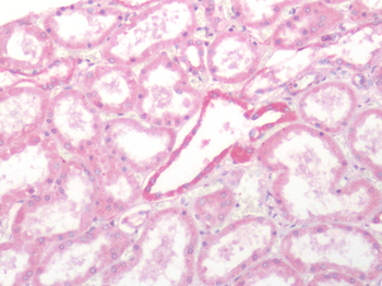 SSTR2 Antibody