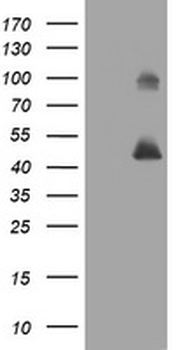 MAGEA3 Antibody