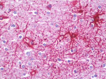 JAKMIP1 Antibody