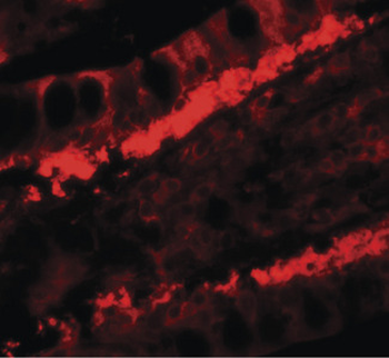 KREMEN1/KREMEN-1 Antibody