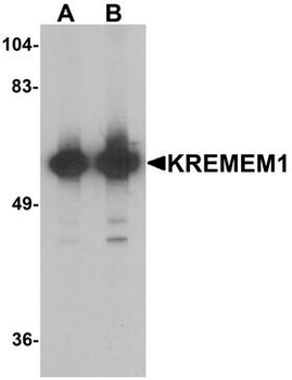 KREMEN1/KREMEN-1 Antibody