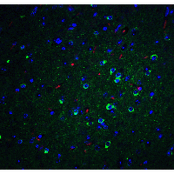 APOE/Apolipoprotein E Antibody