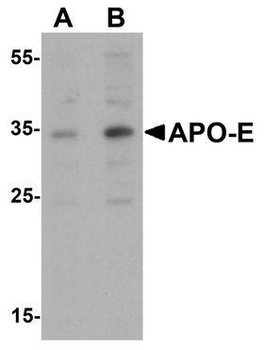 APOE/Apolipoprotein E Antibody