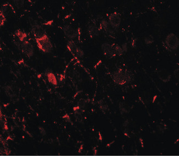 ULK1 Antibody