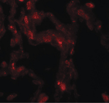 DDC/DOPA Decarboxylase Antibody