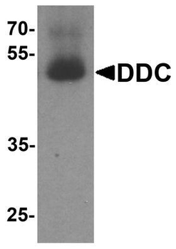 DDC/DOPA Decarboxylase Antibody