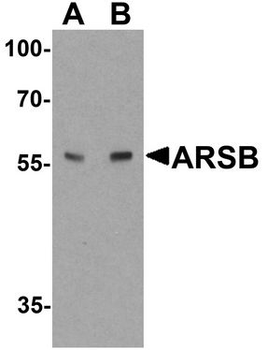 ARSB/Arylsulfatase B Antibody